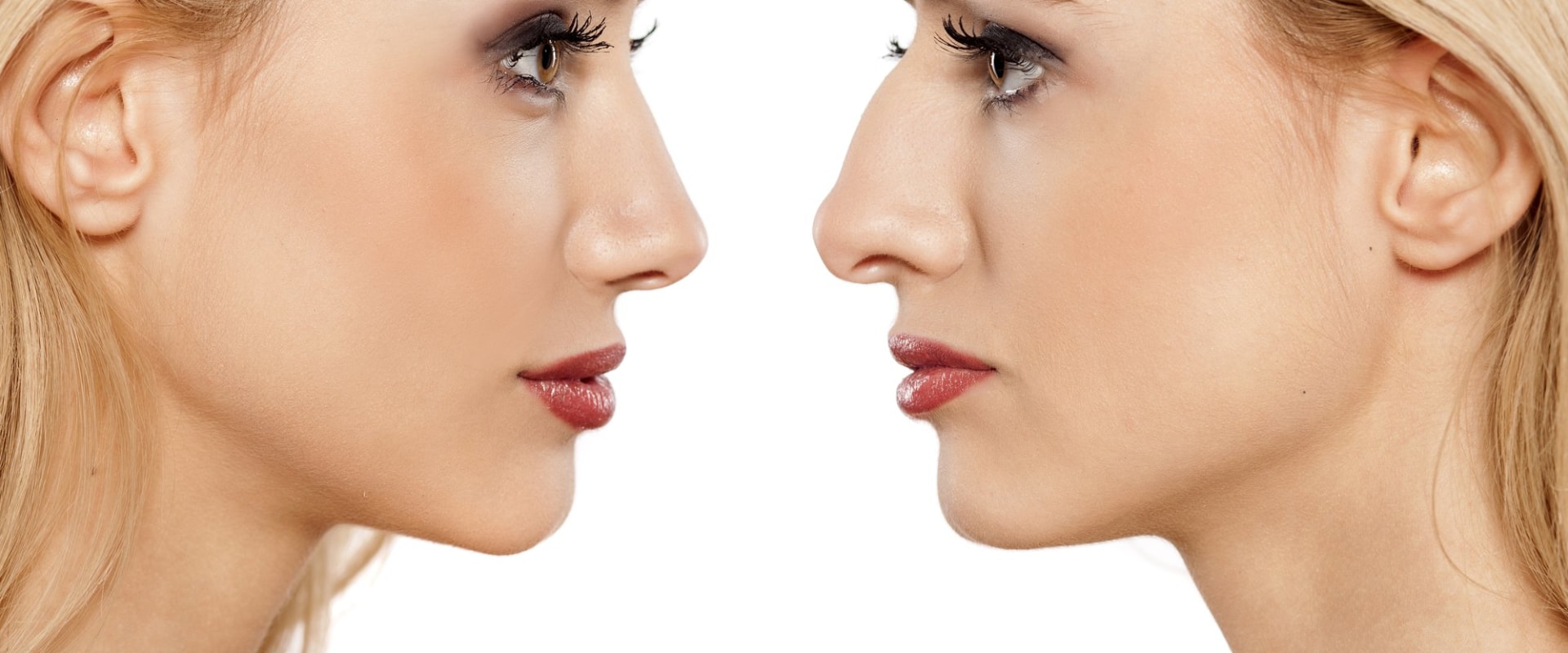 The Longevity of Non-Surgical Nose Reshaping