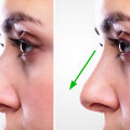 The Ultimate Guide to Choosing the Perfect Nose Job for Your Face